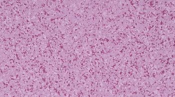 Линолеум Mipolam Affinity 4482 Orchid фото 1 | FLOORDEALER